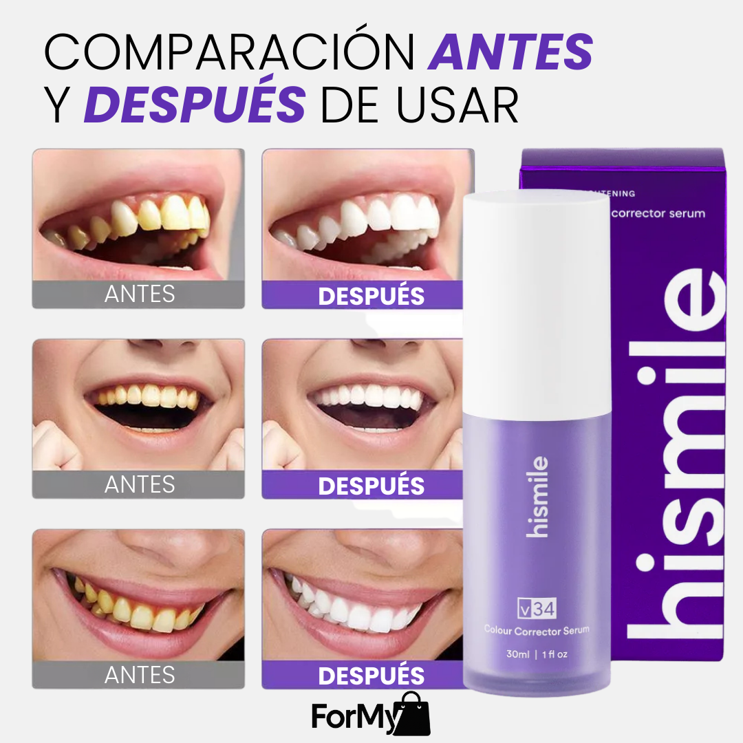 VioletSmile™ Pro - Sonrisa Más Blanca al Instante