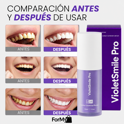 VioletSmile Pro - Sonrisa más blanca y luminosa al instante